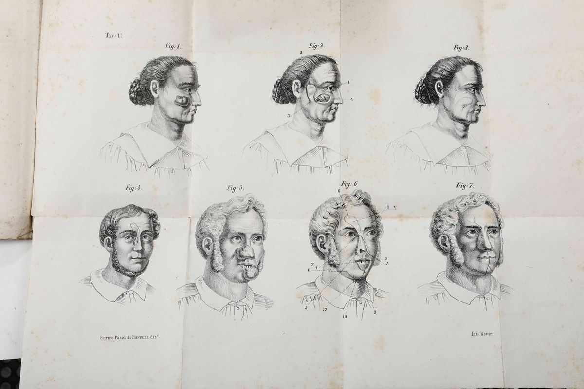 De Ammon, Federico Augustola Chirurgia Plastica Criticamente Esposta... Venezia, Cecchini e Narat...