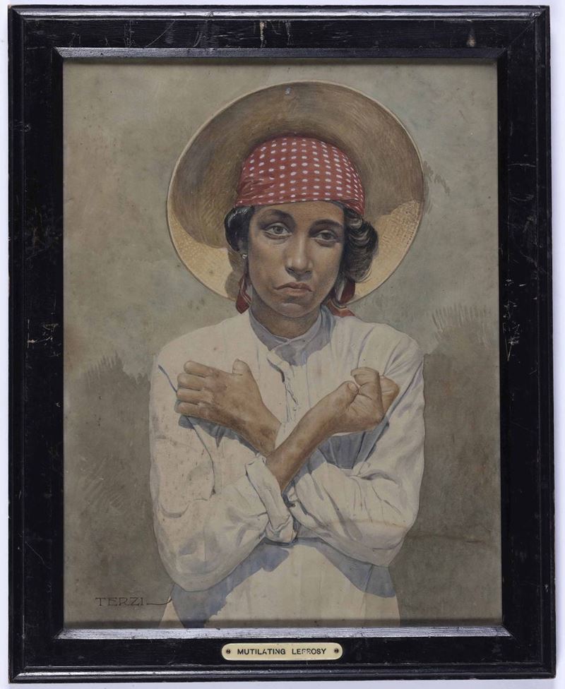 Amedeo Terzi (Palermo 1872-1956) Mutilatin Leprosy  - Auction 19th-20th century paintings - Cambi Casa d'Aste