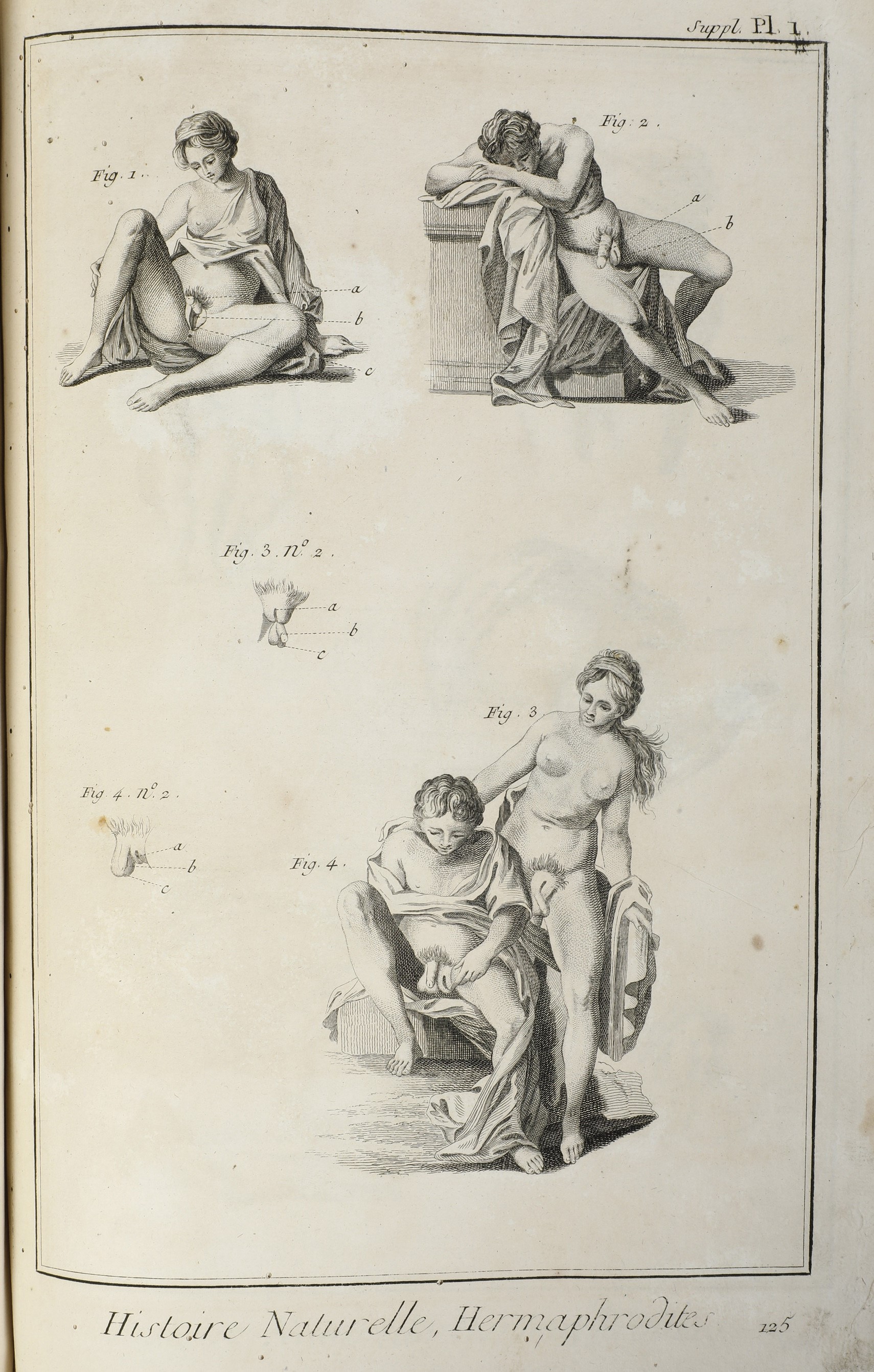 Diderot Denis (1713-1784) / D'alembert Jean Baptiste (1717-1783) Encyclopédie, Ou Dictionnaire Ra...